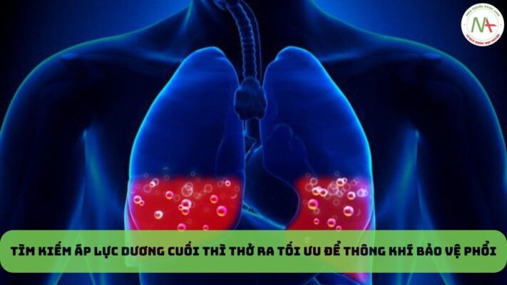 Tìm kiếm áp lực dương cuối thì thở ra tối ưu để thông khí bảo vệ phổi