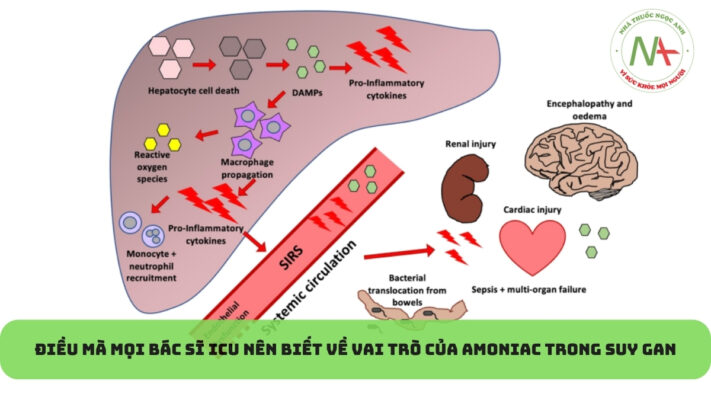 Điều mà mọi bác sĩ ICU nên biết về vai trò của amoniac trong suy gan