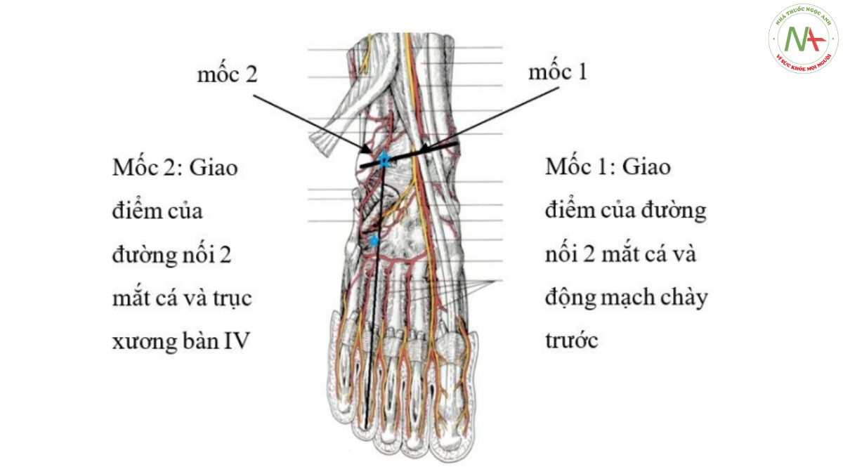 Hình 1: Minh họa xác định vị trí mốc trên da
