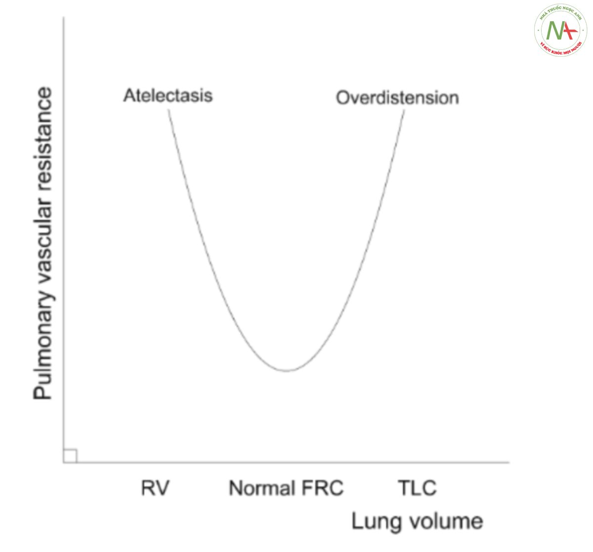 Hình 3 Sức cản mạch máu phổi (PVR), yếu tố chính quyết định hậu tải thất phải, có liên quan đến thể tích phổi theo kiểu hai mặt