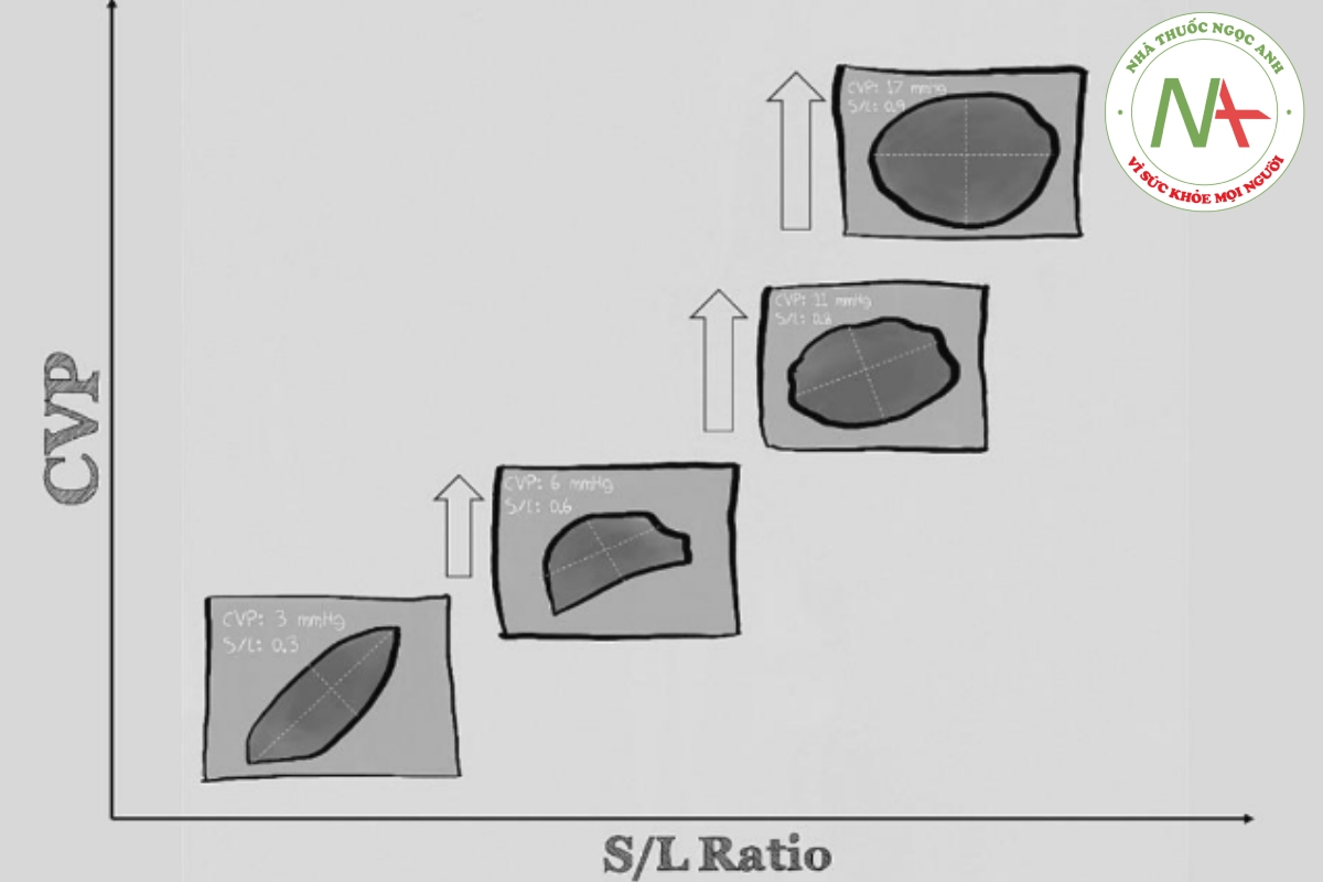 Hình 2. Mối quan hệ giữa áp lực tĩnh mạch trung tâm và tỷ lệ đường kính ngắn và dài. Lưu ý hình dạng elip được quan sát thấy ở hầu hết các IVC ở CVP thấp, khiến LAX mặt phổng đơn trở thành thước đo không đáng tin cậy về độ cậy của IVC.