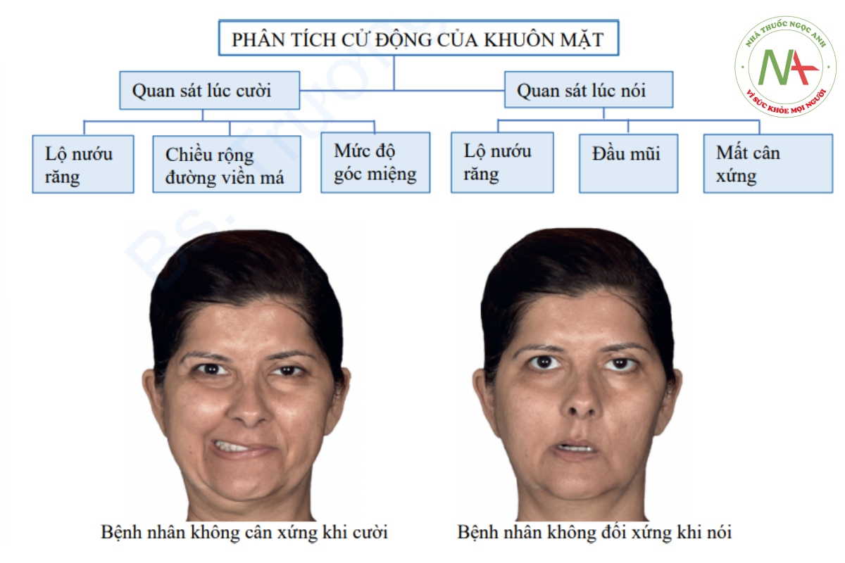 Hình 2-25 Phân tích động học của khuôn mặt bao gồm phân tích bệnh nhân khi cười và khi nói.
