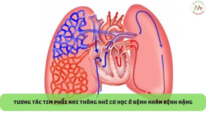 Tương tác tim phổi khi thông khí cơ học ở bệnh nhân bệnh nặng