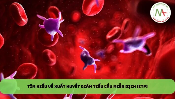 Xuất huyết giảm tiểu cầu miễn dịch