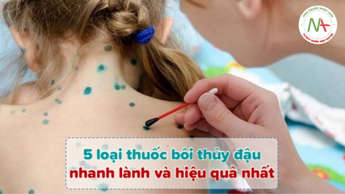 Thuốc bôi thủy đậu