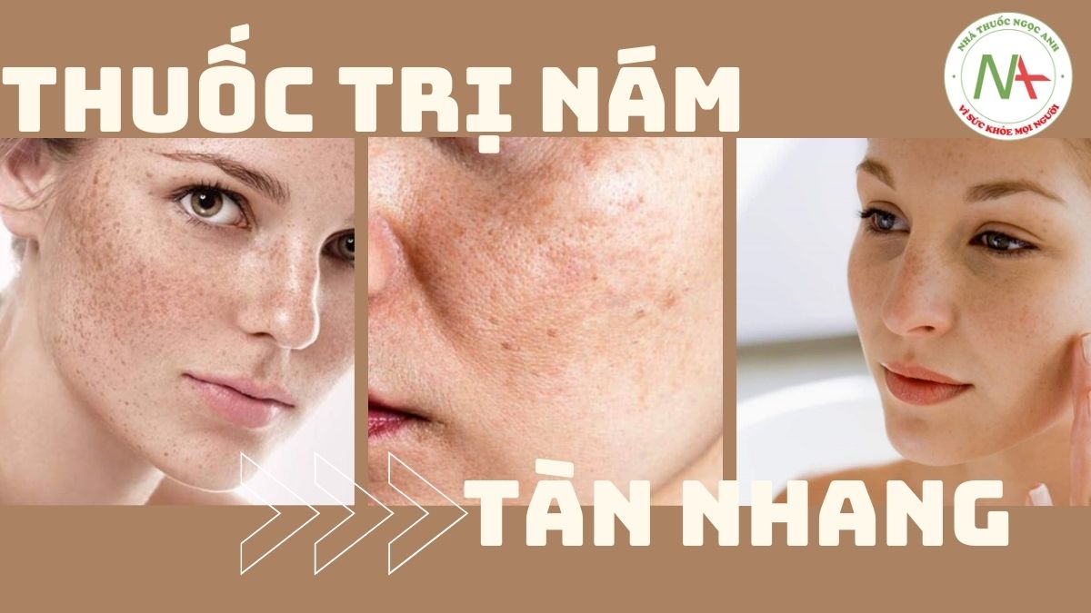 Thuốc trị nám tàn nhang