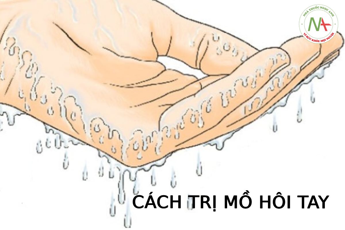 CÁCH TRỊ MỒ HÔI TAY