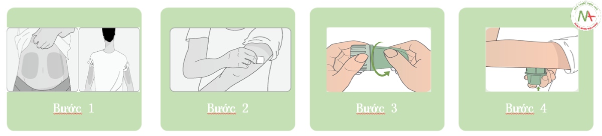 Cách sử dụng LinX Continuous Glucose Monitoring System Sensor