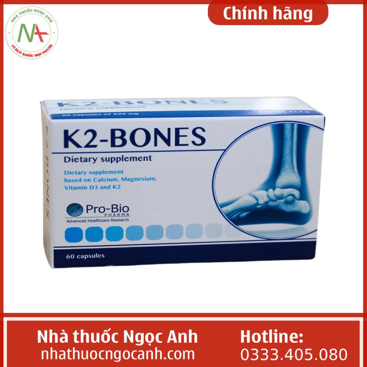 K2-Bones