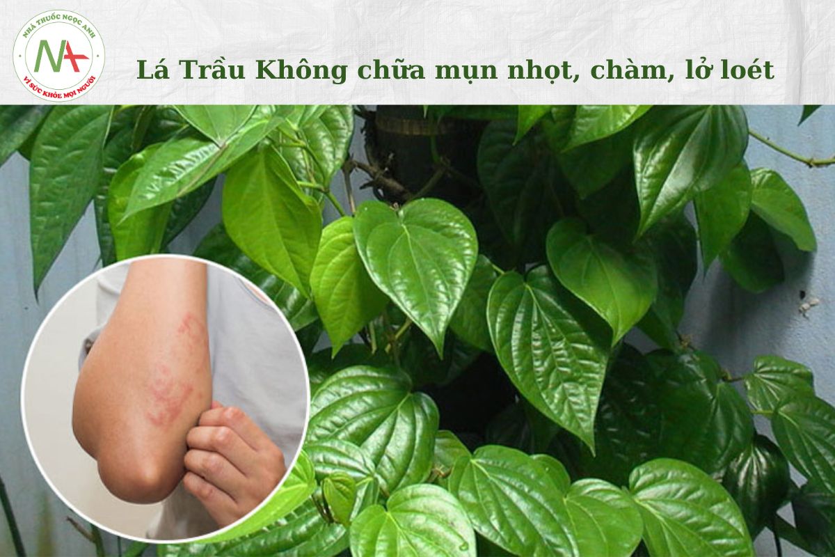 Lá Trầu Không chữa mụn nhọt, chàm, lở loét