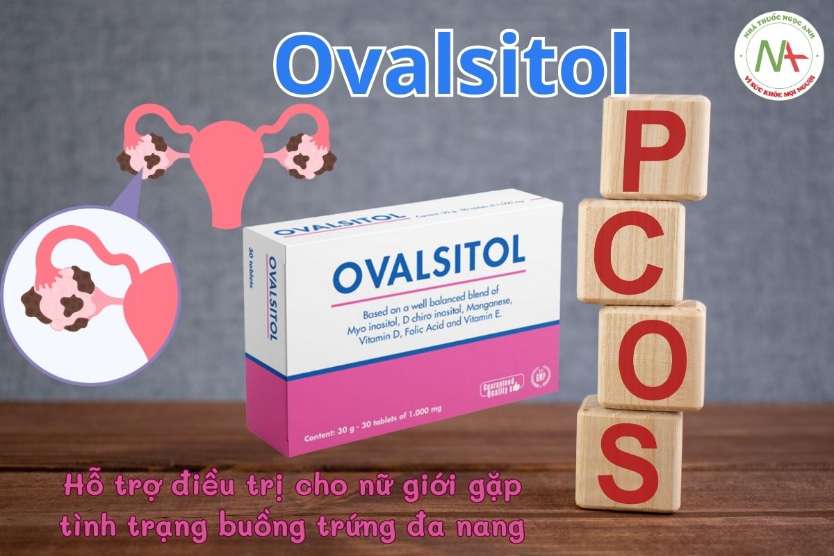 Ovalsitol 3 Ovalsitol hỗ trợ điều trị cho nữ giới gặp tình trạng buồng trứng đa nang