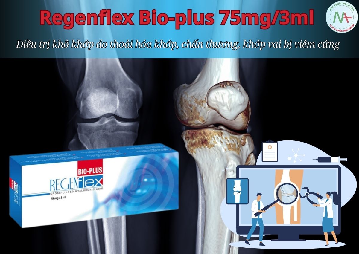 Thuốc Regenflex Bio-plus 75mg/3ml điều trị khô khớp