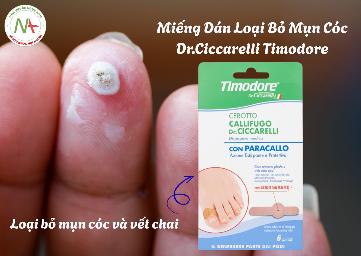Miếng Dán Loại Bỏ Mụn Cóc Dr.Ciccarelli Timodore