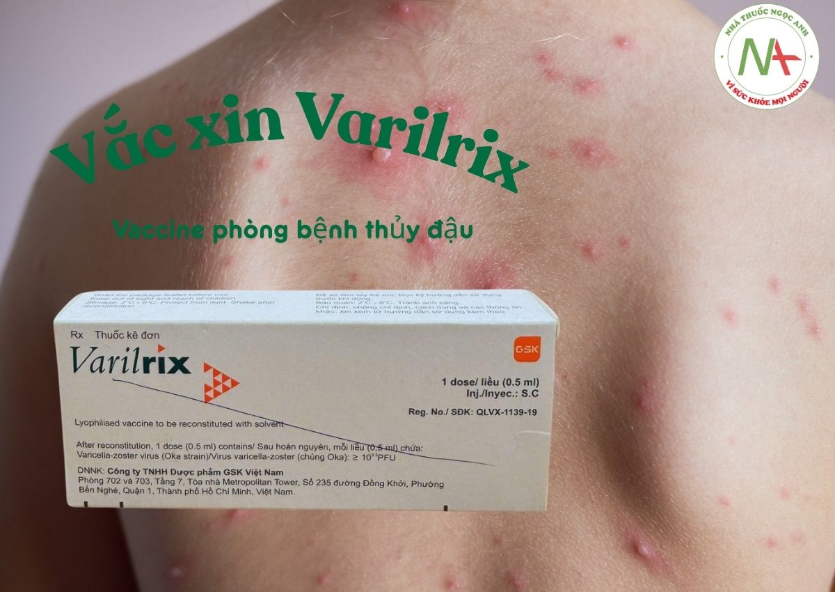 Vắc xin Varilrix 3 Vắc xin Varilrix