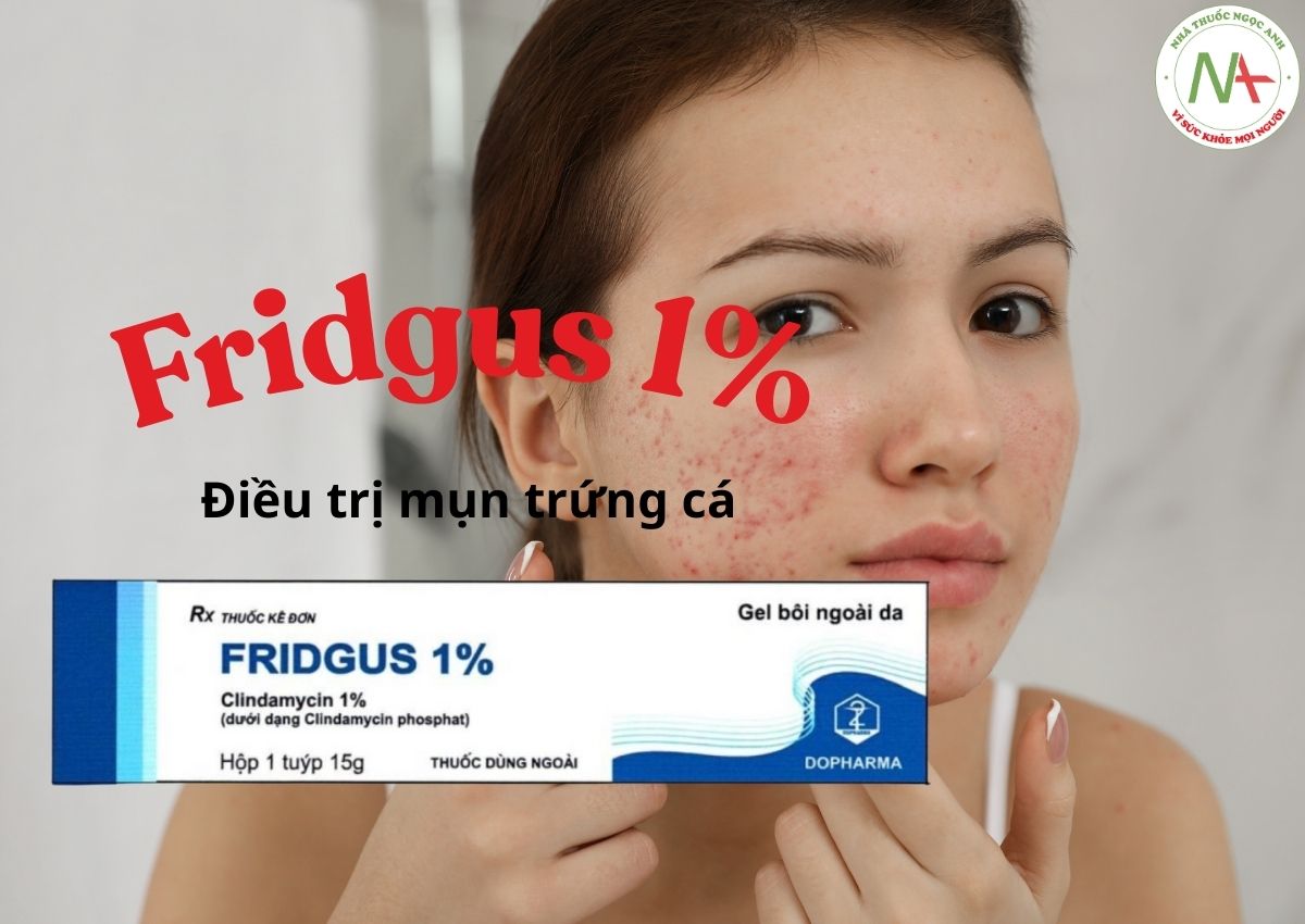 Fridgus 1% 3 Fridgus 1%