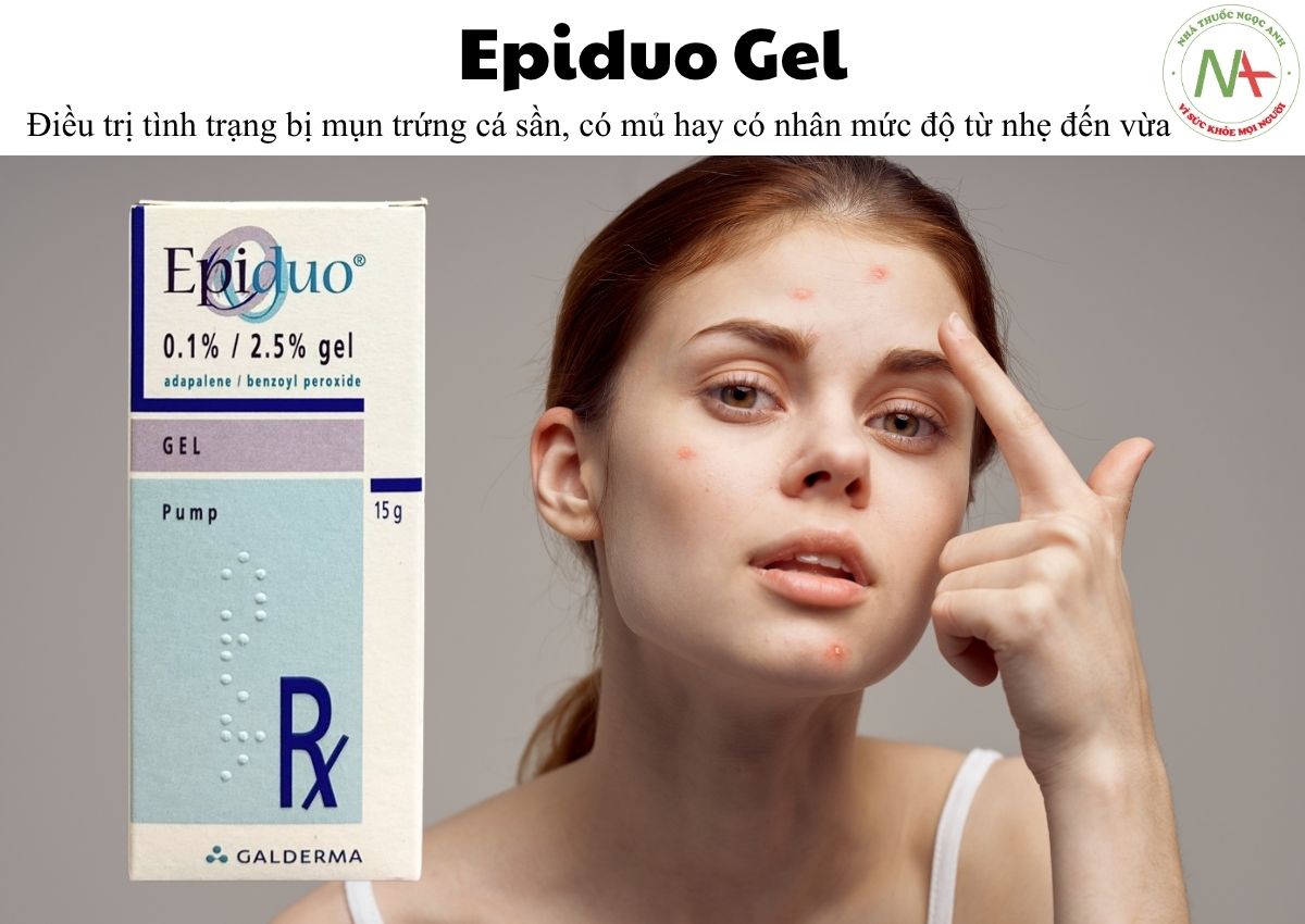 Epiduo Gel 3 Epiduo Gel điều trị mụn trứng cá